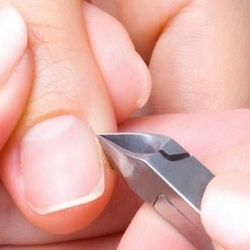 [Tratamento para Unhas Encravadas]