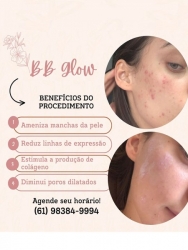 [Tratamento de Pele em Goiânia]